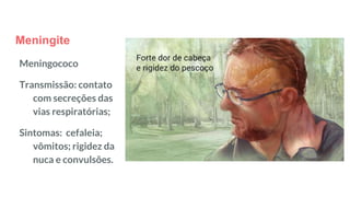 Meningite
Meningococo
Transmissão: contato
com secreções das
vias respiratórias;
Sintomas: cefaleia;
vômitos; rigidez da
nuca e convulsões.
 