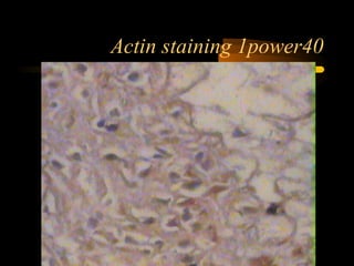 Actin staining 1power40
 