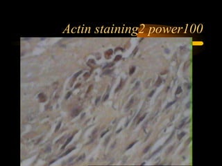 Actin staining2 power100
 
