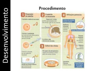 ProcedimentoDesenvolvimento
 