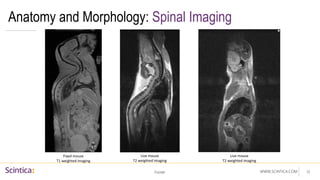 WWW.SCINTICA.COM
Anatomy and Morphology: Spinal Imaging
Footer 13
Fixed mouse
T1 weighted imaging
Live mouse
T2 weighted imaging
Live mouse
T2 weighted imaging
 