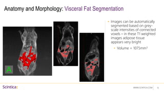 WWW.SCINTICA.COM
Anatomy and Morphology: Visceral Fat Segmentation
• Images can be automatically
segmented based on grey-
scale intensities of connected
voxels – in these T1 weighted
images adipose tissue
appears very bright
• Volume = 1075mm3
15
 