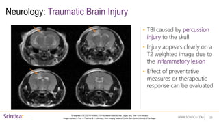 WWW.SCINTICA.COM
Neurology: Traumatic Brain Injury
• TBI caused by percussion
injury to the skull
• Injury appears clearly on a
T2 weighted image due to
the inflammatory lesion
• Effect of preventative
measures or therapeutic
response can be evaluated
20
T2 weighted: FSE (TE/TR=74/2840, FOV=50, Matrix=256x256, Res. 195µm, Acq. Time 13:46 min:sec)
Images courtesy of Prov. A. Friedman & S. Lublinsky – Brain Imaging Research Center, Ben-Gurion University of the Negev
 