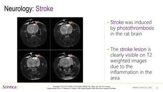 WWW.SCINTICA.COM
Neurology: Stroke
• Stroke was induced
by photothrombosis
in the rat brain
• The stroke lesion is
clearly visible on T2
weighted images
due to the
inflammation in the
area
22
T2 weighted: FSE (TE/TR=74/3030, FOV=50, Matrix=256x256, Res. 195µm, Acq. Time 14:41 min:sec)
Images courtesy of Prov. A. Friedman & S. Lublinsky – Brain Imaging Research Center, Ben-Gurion University of the Negev
 
