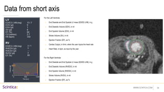 WWW.SCINTICA.COM 34
Data from short axis
For the Left Ventricle:
o End Diastole and End Systole LV mass (ED/ED LVM), in g
o End Diastolic Volume (EDV), in ml
o End Systolic Volume (ESV), in ml
o Stroke Volume (SV), in ml
o Ejection Fraction (EF), as %
o Cardiac Output, in l/min, when the user inputs the heart rate
o Heart Rate, in bpm, as input by the user
For the Right Ventricle:
o End Diastole and End Systole LV mass (ED/ED LVM), in g
o End Diastolic Volume (RVEDV), in ml
o End Systolic Volume (RVESV), in ml
o Stroke Volume (RVSV), in ml
o Ejection Fraction (EF), as %
 