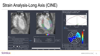 WWW.SCINTICA.COM
Strain Analysis-Long Axis (CINE)
35
 