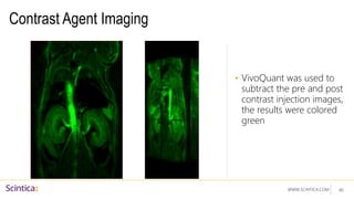 WWW.SCINTICA.COM
Contrast Agent Imaging
• VivoQuant was used to
subtract the pre and post
contrast injection images,
the results were colored
green
40
 