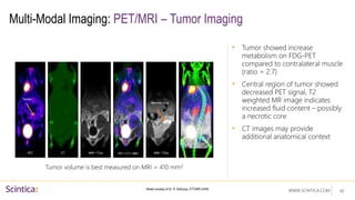 WWW.SCINTICA.COM
Multi-Modal Imaging: PET/MRI – Tumor Imaging
• Tumor showed increase
metabolism on FDG-PET
compared to contralateral muscle
(ratio = 2.7)
• Central region of tumor showed
decreased PET signal, T2
weighted MR image indicates
increased fluid content – possibly
a necrotic core
• CT images may provide
additional anatomical context
45
Model courtesy of Dr. R. DeSouza, STTARR (UHN)
PET PET + CT + MRI
MRI – T1w
CT MRI – T2w
Necrotic Core
Tumor
Tumor volume is best measured on MRI = 410 mm3
 
