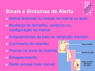Sinais e Sintomas de Alerta
 Mama dolorosa ou nódulo na mama ou axila;
 Mudança de tamanho, contorno ou
configuração da mama;
 Irregularidades da pele ou retracção mamilar;
 Corrimento do mamilo;
 Prurido na zona do mamilo;
 Emagrecimento;
 Rede venosa mais visível;
 