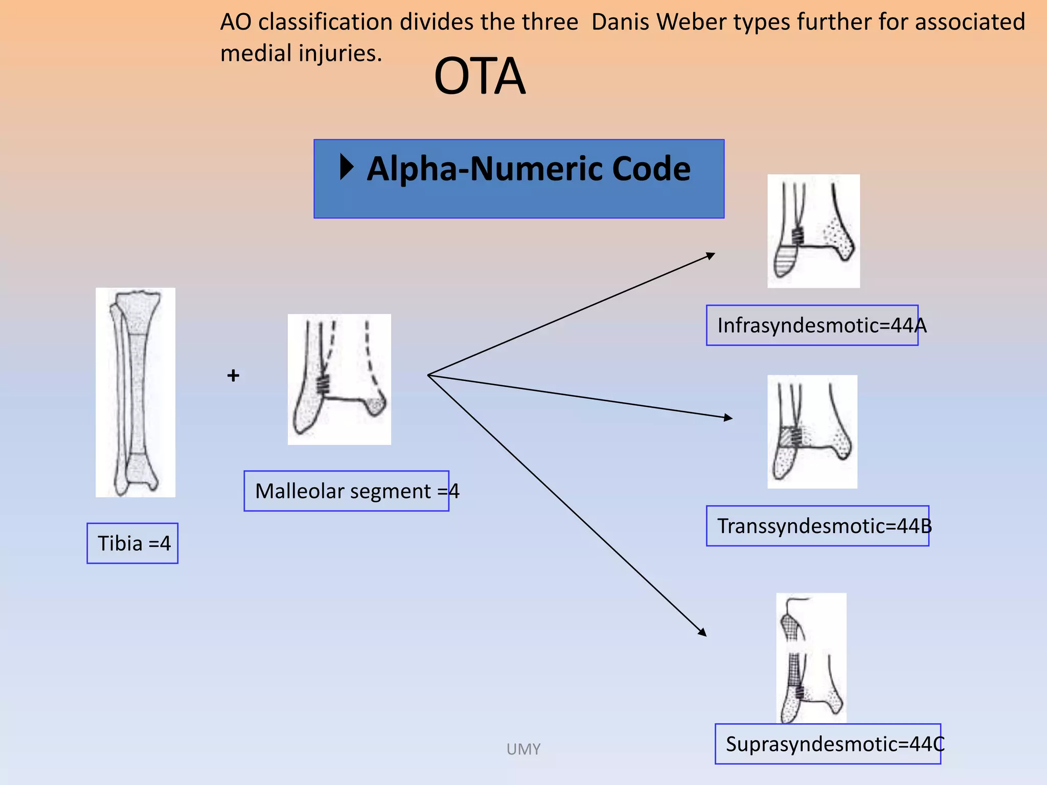 ANKLE FRACTURES | PPTX