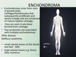 ENCHONDROMA
• Enchondromas arise from rests
of growth plate
cartilage/chondrocytes that
subsequently proliferate and
slowly enlarge and are composed
of mature hyaline cartilage.
• they are seen in any bone
formed from cartilage.
• Two syndromes are associated
with multiple enchondromas:
Ollier disease
Maffucci syndrome.
• small tubular bones of the hands
and feet : 50%
• large tubular bones e.g. femur,
tibia, humerus UMY
 