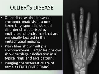 OLLIER”S DISEASE
• Ollier disease also known as
enchondromatosis, is a non-
hereditary, sporadic, skeletal
disorder characterised by
multiple enchondromas that are
principally located in the
metaphyseal regions.
• Plain films show multiple
enchondromas. Larger lesions can
show cartilage calcification in a
typical rings and arcs pattern.
• Imaging characterestics are of
same as ENCHONDROMAS
UMY
 