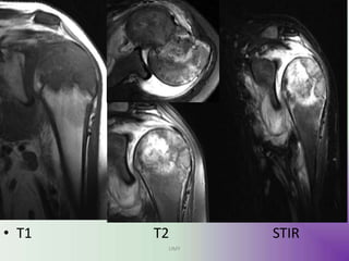 image
• T1 T2 STIR
UMY
 