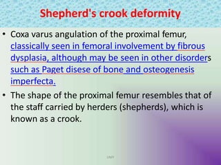 Shepherd's crook deformity
UMY
• Coxa varus angulation of the proximal femur,
classically seen in femoral involvement by fibrous
dysplasia, although may be seen in other disorders
such as Paget disese of bone and osteogenesis
imperfecta.
• The shape of the proximal femur resembles that of
the staff carried by herders (shepherds), which is
known as a crook.
 