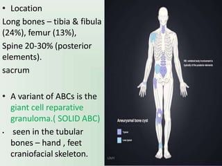 • Location
Long bones – tibia & fibula
(24%), femur (13%),
Spine 20-30% (posterior
elements).
sacrum
• A variant of ABCs is the
giant cell reparative
granuloma.( SOLID ABC)
• seen in the tubular
bones – hand , feet
craniofacial skeleton. UMY
 