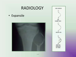 RADIOLOGY
• Expansile
UMY
 
