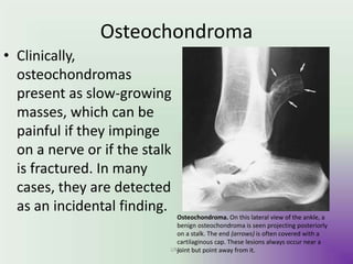 Osteochondroma
• Clinically,
osteochondromas
present as slow-growing
masses, which can be
painful if they impinge
on a nerve or if the stalk
is fractured. In many
cases, they are detected
as an incidental finding.
Osteochondroma. On this lateral view of the ankle, a
benign osteochondroma is seen projecting posteriorly
on a stalk. The end (arrows) is often covered with a
cartilaginous cap. These lesions always occur near a
joint but point away from it.UMY
 