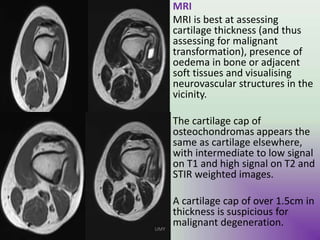• MRI
• MRI is best at assessing
cartilage thickness (and thus
assessing for malignant
transformation), presence of
oedema in bone or adjacent
soft tissues and visualising
neurovascular structures in the
vicinity.
• The cartilage cap of
osteochondromas appears the
same as cartilage elsewhere,
with intermediate to low signal
on T1 and high signal on T2 and
STIR weighted images.
• A cartilage cap of over 1.5cm in
thickness is suspicious for
malignant degeneration.UMY
 