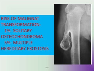 RISK OF MALIGNAT
TRANSFORMATION-
1%- SOLITARY
OSTEOCHONDROMA
5%- MULTIPLE
HEREDITARY EXOSTOSIS
UMY
 