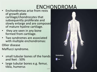 ENCHONDROMA• Enchondromas arise from rests
of growth plate
cartilage/chondrocytes that
subsequently proliferate and
slowly enlarge and are composed
of mature hyaline cartilage.
• they are seen in any bone
formed from cartilage.
• Two syndromes are associated
with multiple enchondromas:
Ollier disease
Maffucci syndrome.
• small tubular bones of the hands
and feet : 50%
• large tubular bones e.g. femur,
tibia, humerus UMY
 