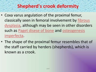 Shepherd's crook deformity
• Coxa varus angulation of the proximal femur,
classically seen in femoral involvement by fibrous
dysplasia, although may be seen in other disorders
such as Paget disese of bone and osteogenesis
imperfecta.
• The shape of the proximal femur resembles that of
the staff carried by herders (shepherds), which is
known as a crook.
UMY
 