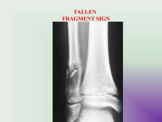 FALLEN
FRAGMENT SIGN
UMY
 