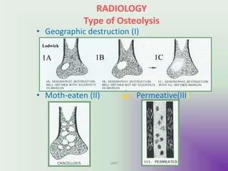 RADIOLOGY
Type of Osteolysis
• Geographic destruction (I)
• Moth-eaten (II) Permeative(III)
Lodwick
1A 1B 1C
UMY
 