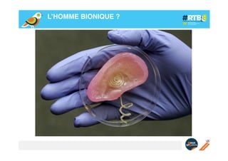 L’HOMME BIONIQUE ?!

 