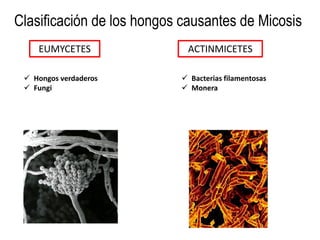 Clasificación de los hongos causantes de Micosis
EUMYCETES
 Hongos verdaderos
 Fungi
ACTINMICETES
 Bacterias filamentosas
 Monera
 