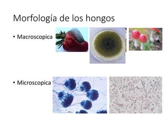 Morfología de los hongos
• Macroscopica
• Microscopica
 