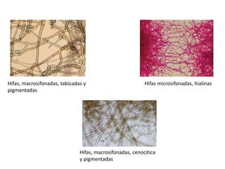 Hifas microsifonadas, hialinas
Hifas, macrosifonadas, tabicadas y
pigmentadas
Hifas, macrosifonadas, cenocitica
y pigmentadas
 