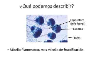 ¿Qué podemos describir?
• Micelio filamentoso, mas micelio de fructificación
Esporas
Hifas
Esporóforo
(hifa faertil)
 