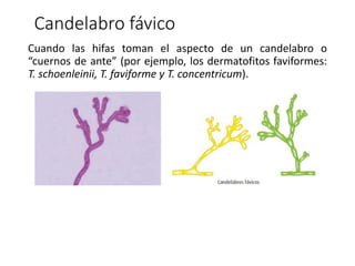 Cuando las hifas toman el aspecto de un candelabro o
“cuernos de ante” (por ejemplo, los dermatofitos faviformes:
T. schoenleinii, T. faviforme y T. concentricum).
Candelabro fávico
 