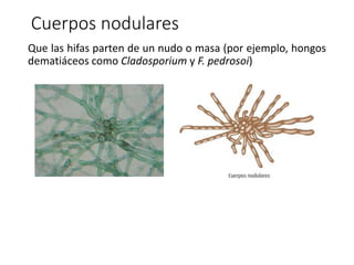 Que las hifas parten de un nudo o masa (por ejemplo, hongos
dematiáceos como Cladosporium y F. pedrosoi)
Cuerpos nodulares
 