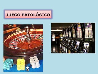 JUEGO PATOLÓGICO
 