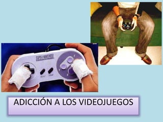 ADICCIÓN A LOS VIDEOJUEGOS
 