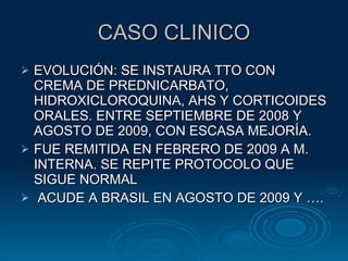 CASO CLINICO EVOLUCIÓN: SE INSTAURA TTO CON CREMA DE PREDNICARBATO, HIDROXICLOROQUINA, AHS Y CORTICOIDES ORALES. ENTRE SEPTIEMBRE DE 2008 Y AGOSTO DE 2009, CON ESCASA MEJORÍA. FUE REMITIDA EN FEBRERO DE 2009 A M. INTERNA. SE REPITE PROTOCOLO QUE SIGUE NORMAL ACUDE A BRASIL EN AGOSTO DE 2009 Y …. 