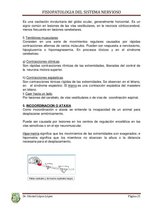 oscilacion espasmodica del globo ocular una fisiop sist nervioso oscilacion espasmodica del globo ocular una fisiop sist nervioso