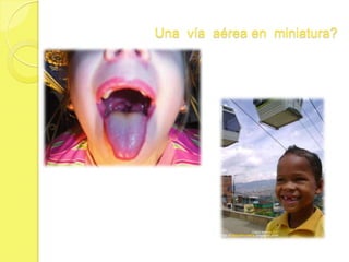 Técnica de intubación endotraqueal  en  niños 