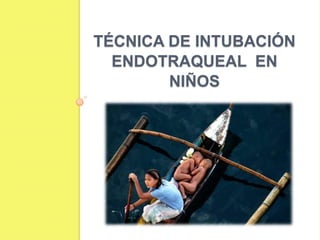 Aditamentos para  manejo VAUna  vía  aérea en  miniatura?