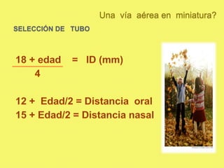 Una  vía  aérea en  miniatura?