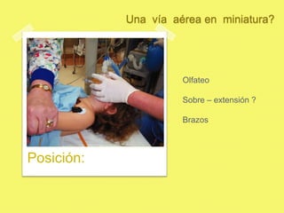 Laringoscopia convencional Exposición:Una  vía  aérea en  miniatura?