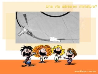 Una  vía  aérea en  miniatura?FIBROBRONCOSCOPIOLimitación apertura oral