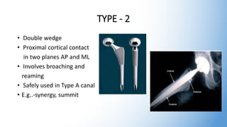 TYPE - 2
• Double wedge
• Proximal cortical contact
in two planes AP and ML
• Involves broaching and
reaming
• Safely used in Type A canal
• E.g..-synergy, summit
15
 