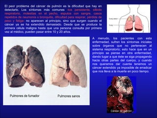 El peor problema del cáncer de pulmón es la dificultad que hay en detectarlo. Los síntomas más comunes  -tos persistente, silbido respiratorio, molestias en el pecho, esputos con sangre, casos repetidos de neumonía o bronquitis, dificultad para respirar, pérdida de peso y fatiga-  no aparecen al principio, sino que surgen cuando el cáncer ya se ha extendido demasiado. Desde que se produce la primera célula maligna hasta que una persona consulta por primera vez al médico, pueden pasar entre 10 y 20 años.    A menudo, los pacientes con esta enfermedad, sufren los síntomas iniciales sobre órganos que no pertenecen al sistema respiratorio; esto hace que en un principio se piense en otra enfermedad, dando lugar a que éste se siga propagando hacia otras partes del cuerpo, y cuando nos queramos dar cuenta tenemos un cáncer extendido ya imposible de erradicar que nos lleva a la muerte en poco tiempo. 