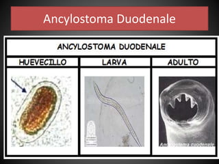 Ancylostoma Duodenale
 