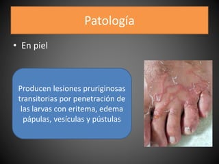 Patología
• En piel
Producen lesiones pruriginosas
transitorias por penetración de
las larvas con eritema, edema
pápulas, vesículas y pústulas
 