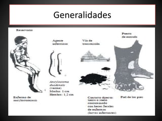 Generalidades
 