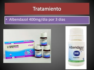 • Albendazol 400mg/dia por 3 dias
 