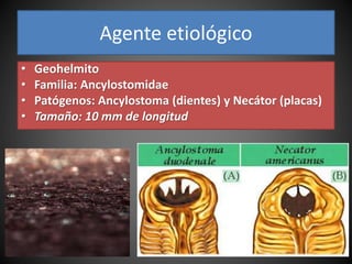 Agente etiológico
• Geohelmito
• Familia: Ancylostomidae
• Patógenos: Ancylostoma (dientes) y Necátor (placas)
• Tamaño: 10 mm de longitud
 